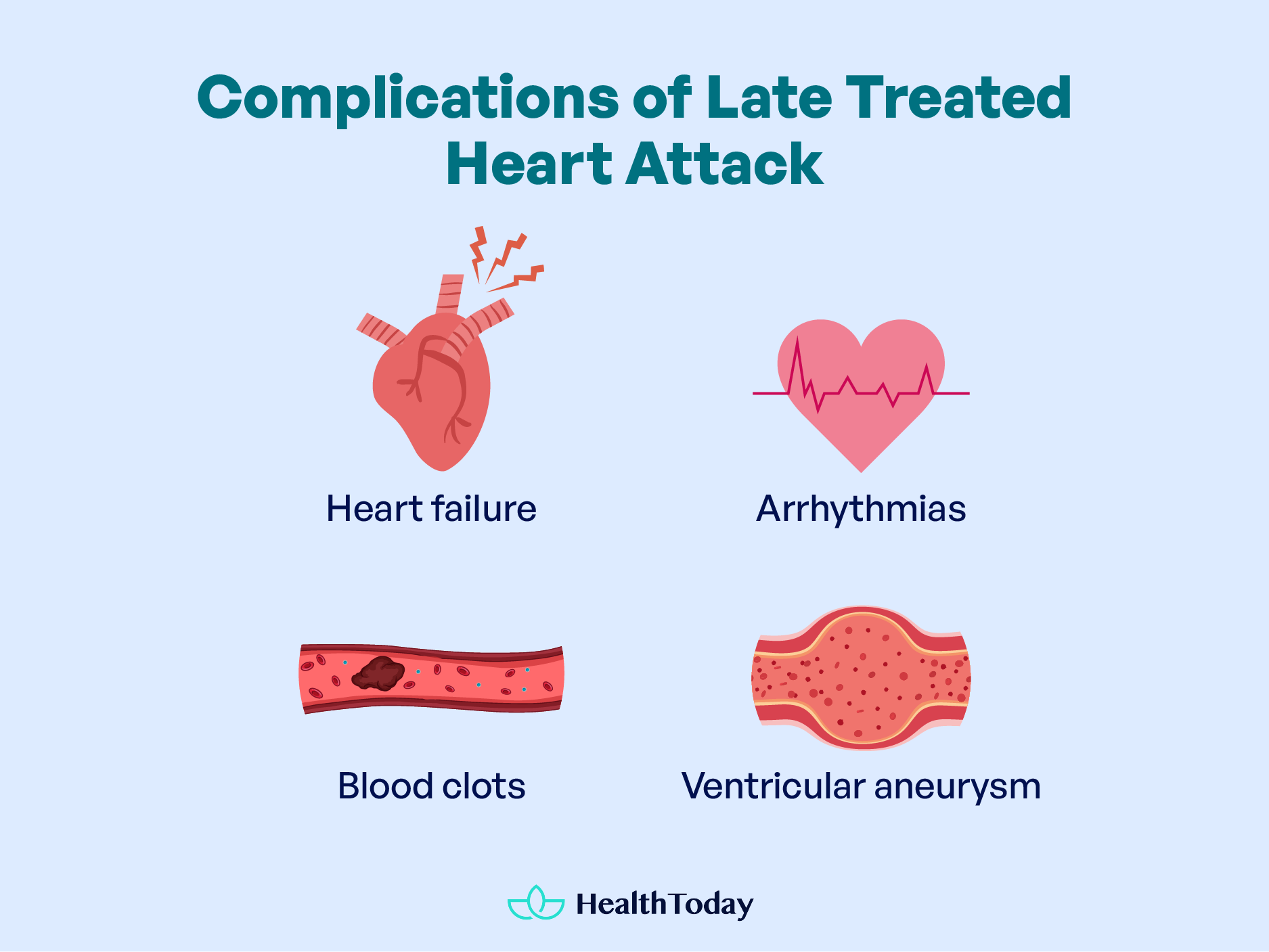 Is Jaw Pain a Sign of a Heart Attack 03